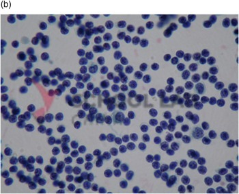 Prepared Microscope Slide - Brewers Yeast (Saccharomyces cerevisae): Budding Cells W.M.